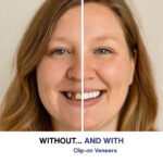 Aufsteckbare Verblendungen - Image 3