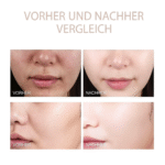 Glas-Haut Premium-Kit (6 Stück) - Image 3