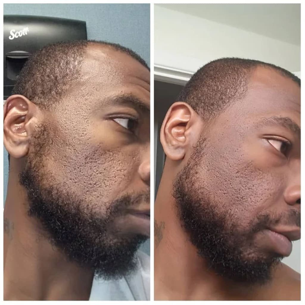 Glas-Haut Premium-Kit (6 Stück) - Image 6